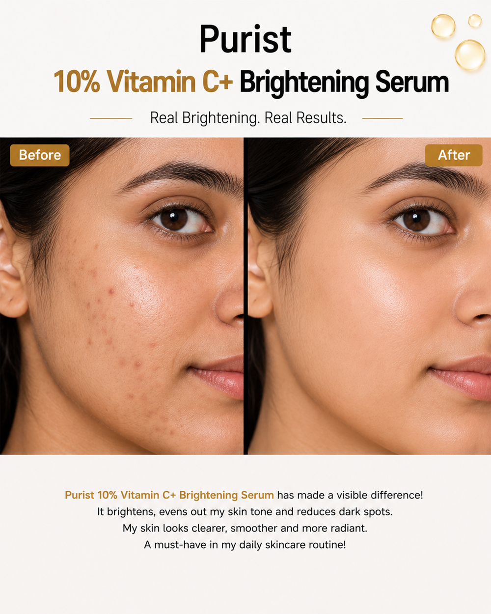 10% Vitamin C+ Brightening Serum