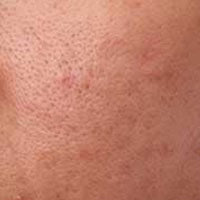 Texture & Pores