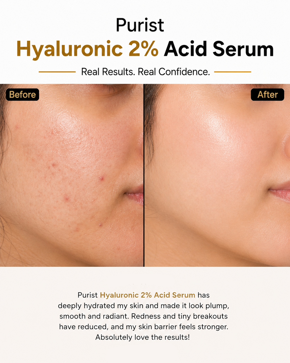 Purist Hyaluronic 2% Acid Serum