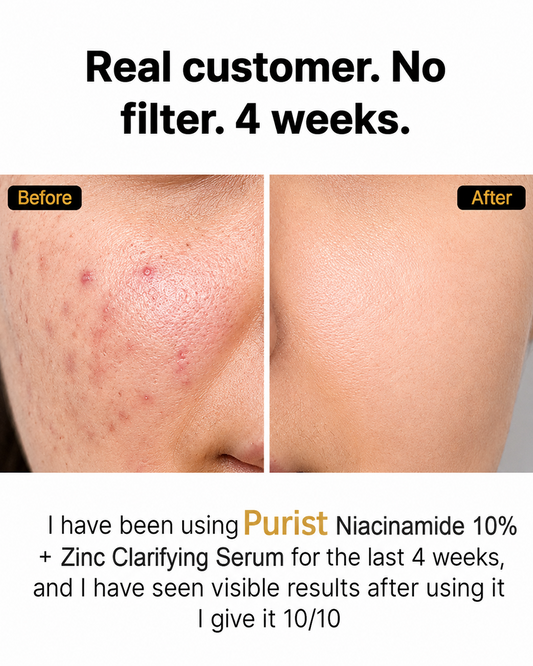 Purist Niacinamide 10% + Zinc Clarifying Serum