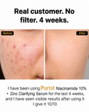 Purist Niacinamide 10% + Zinc Clarifying Serum