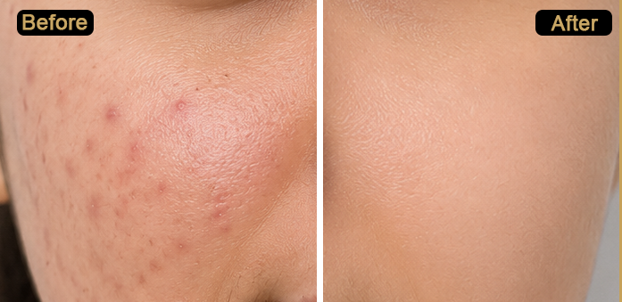 Purist Niacinamide 10% + Zinc Clarifying Serum