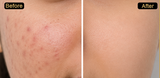 Purist Niacinamide 10% + Zinc Clarifying Serum