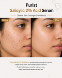 Purist Salicylic 2% Acid Serum