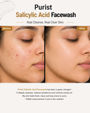 Purist Salicylic Acid Facewash