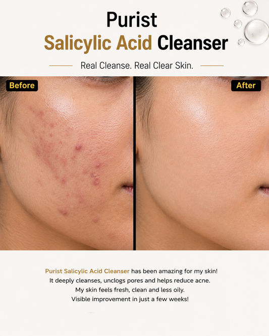 Salicylic Acid Cleanser