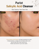 Salicylic Acid Cleanser