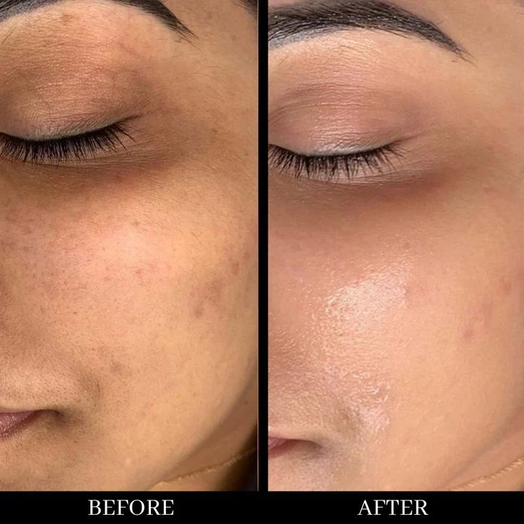 10% Vitamin C+ Brightening Serum